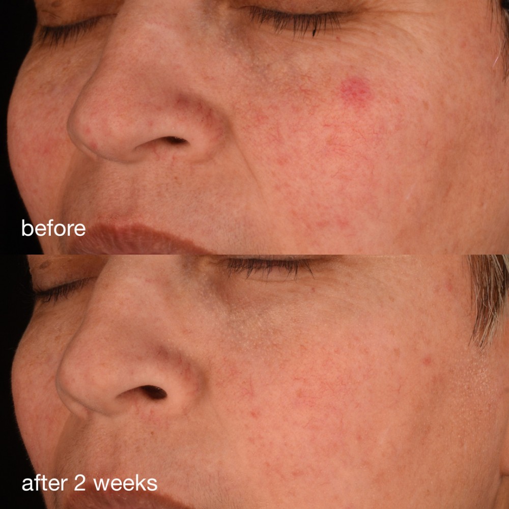 Dermalogica - Антиоксидантна сироватка з колагеном (Фото-4)