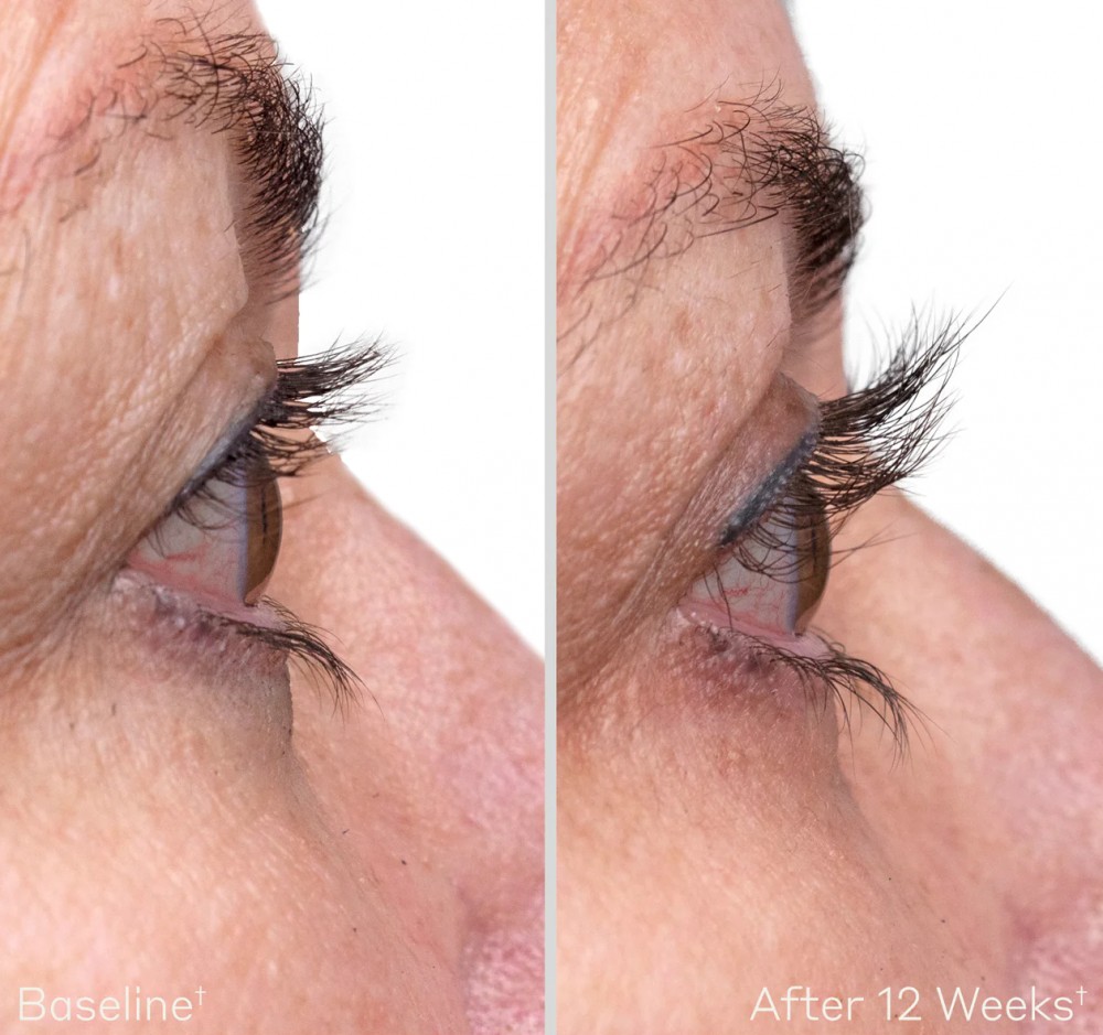 Obagi Medical - Сироватка для покращення росту та об'єму вій (Фото-3)