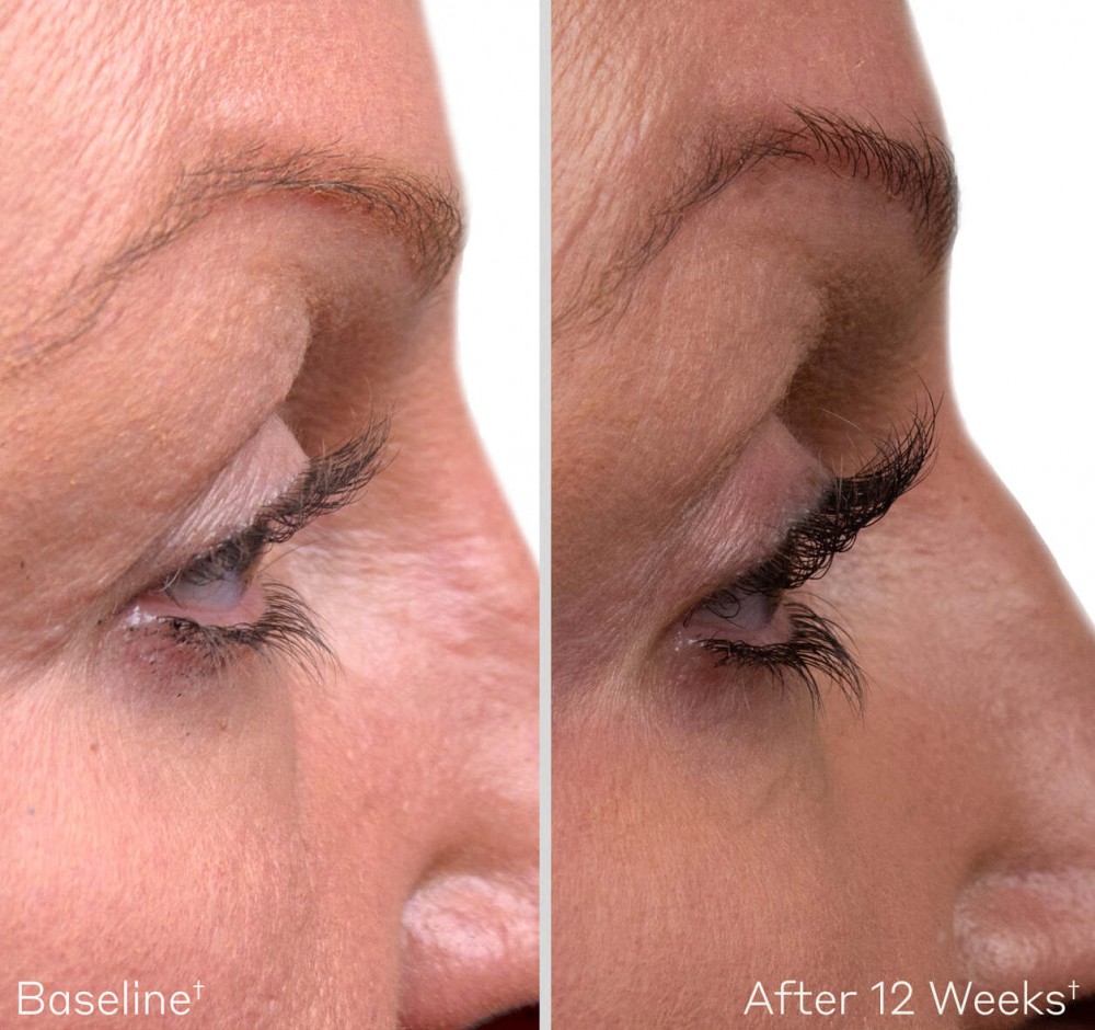 Obagi Medical - Сироватка для покращення росту та об'єму вій (Фото-4)