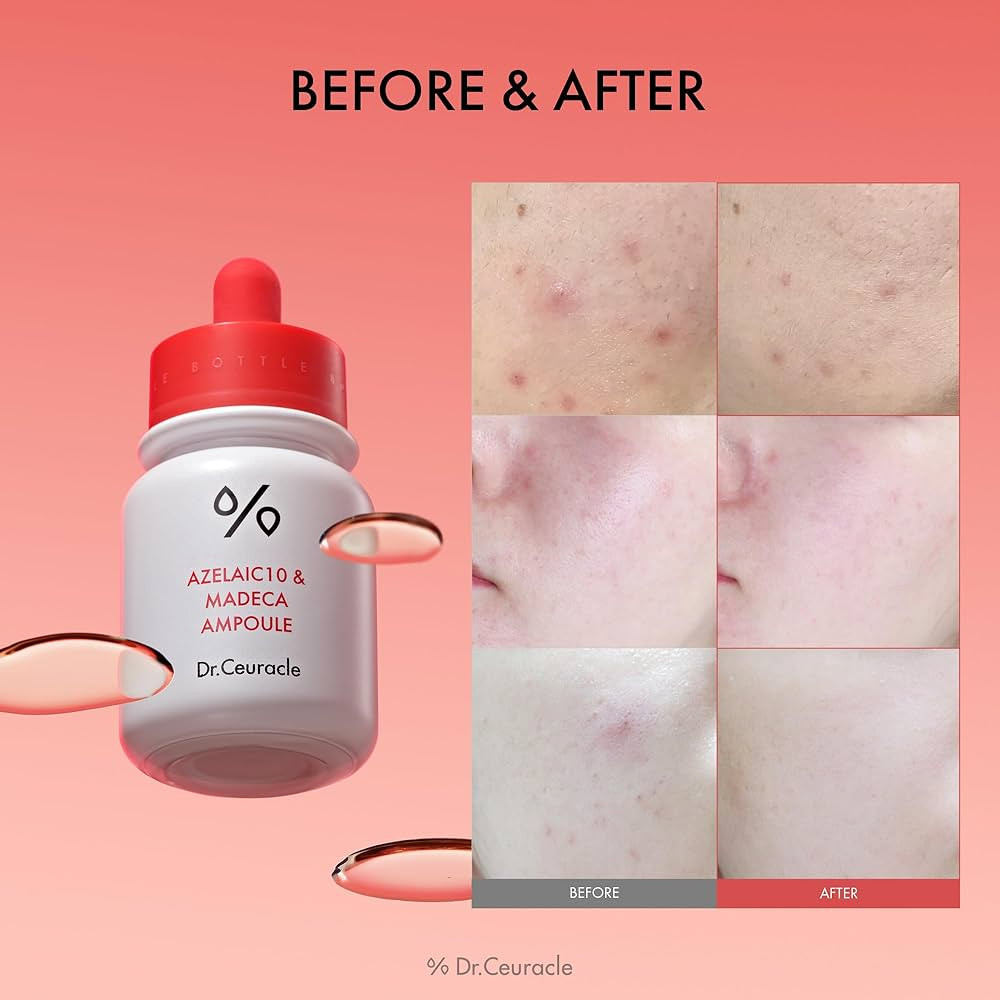 Dr.Ceuracle - Сироватка з азелаїновою кислотою 10% та мадекасосидом (Фото-3)