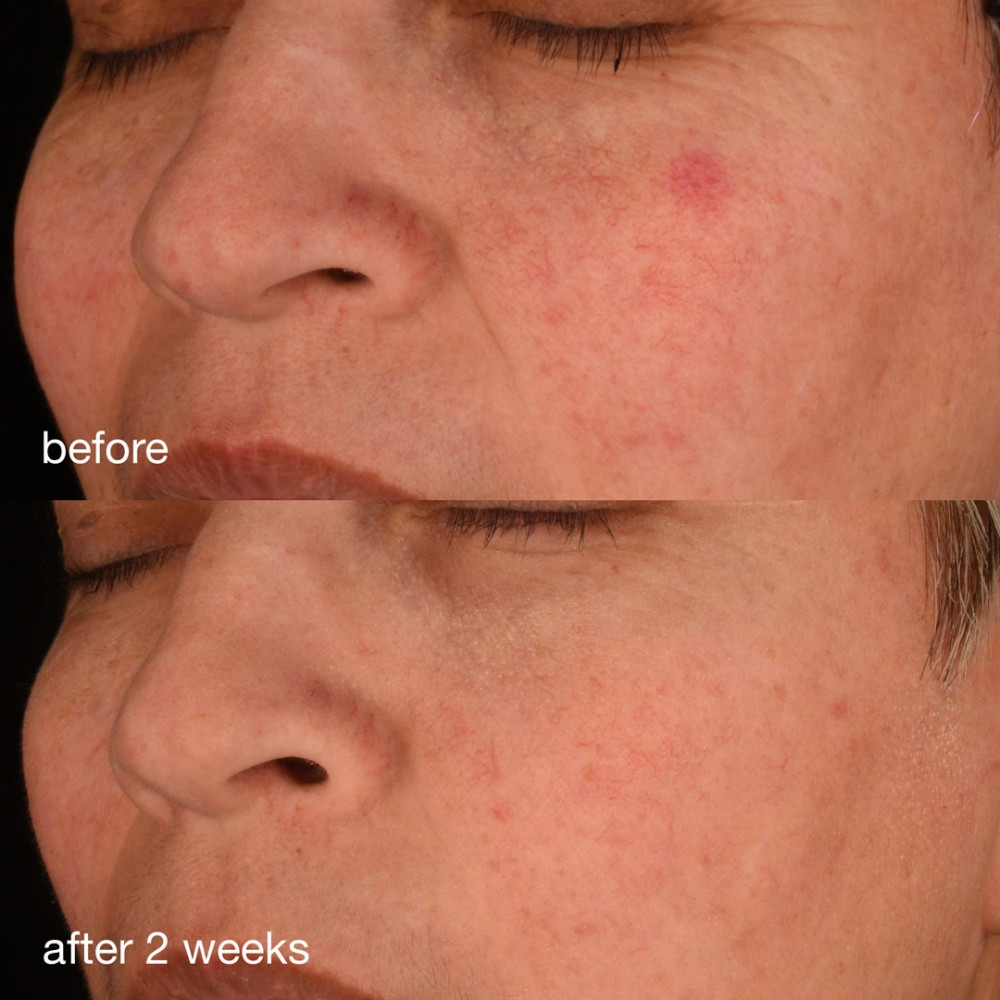 Dermalogica - Антиоксидантная сыворотка с коллагеном (Фото-4)