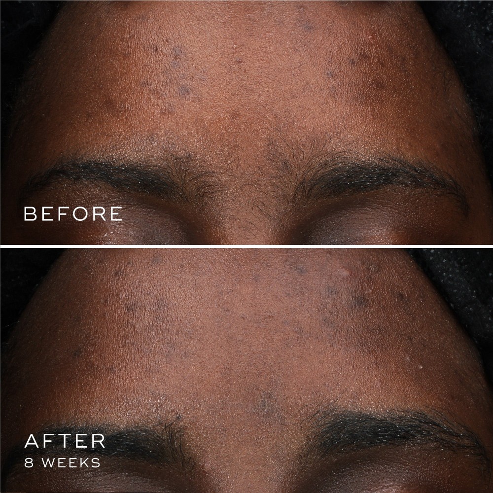 Medik8 - Пептидная сыворотка от пигментации с оксиресвератролом (Фото-2), fabo.ua Medik8 - Пептидная сыворотка от пигментации с оксиресвератролом (Фото-2)